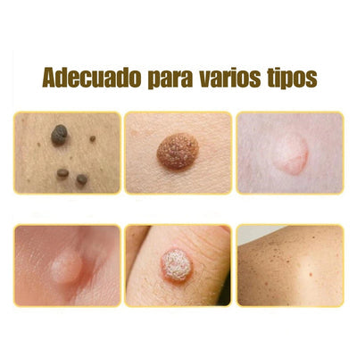 ELIMINADOR DE VERRUGAS